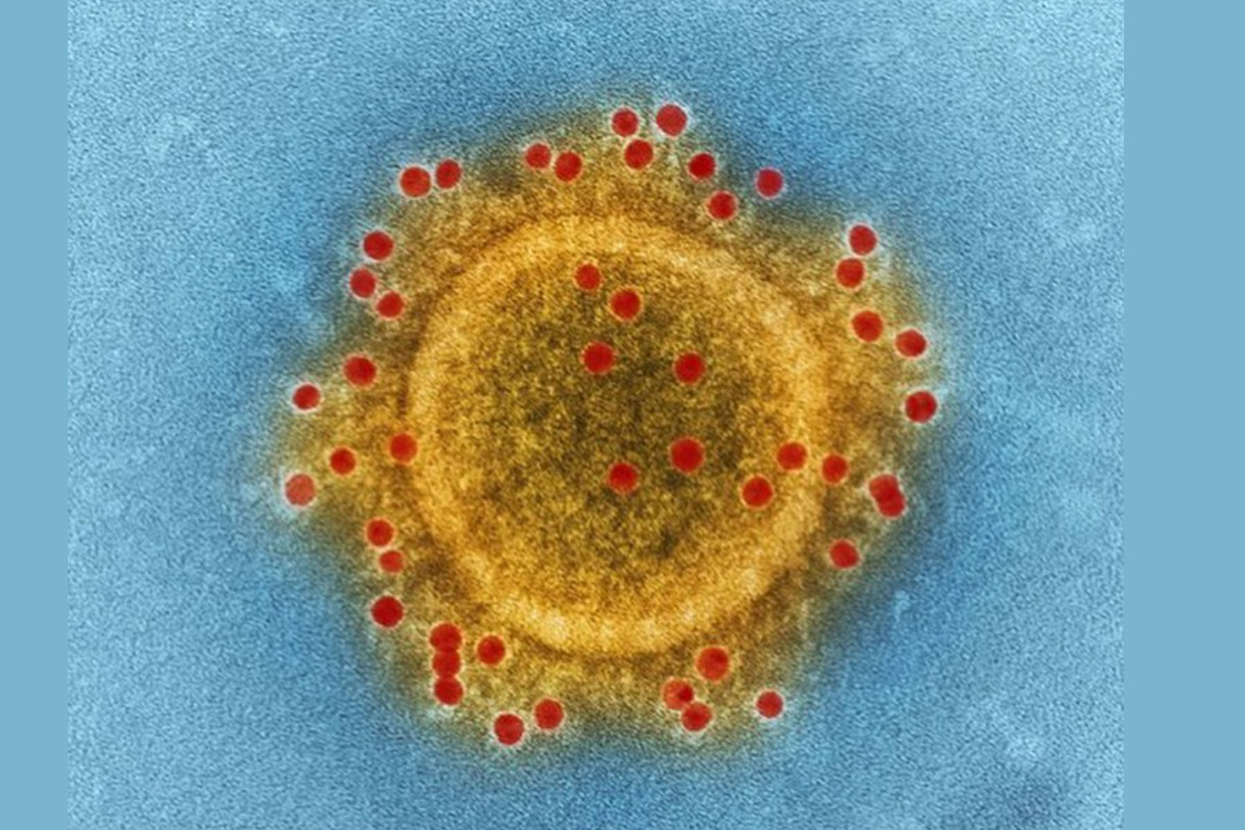 coronavirus